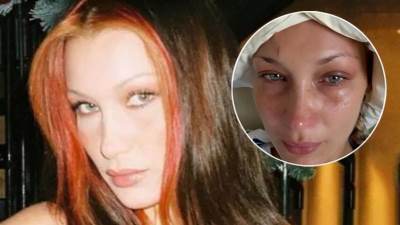  Bela Hadid o lajmskoj bolesti 