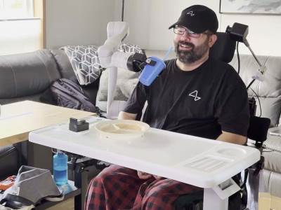  Muškarac koji je ugradio Neuralink implant 