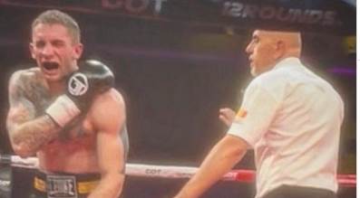  Boks Albanac ugrizao Srbina  