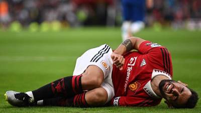  Bruno Fernandeš povrijeđen 