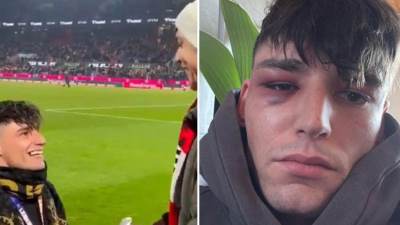  Pretučen sudija koji je zaprosio dečka 