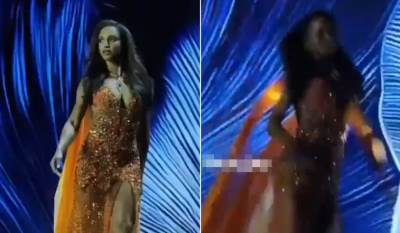  Mis Jamajke koja je propala kroz binu na takmičenju objavila slike iz bolnice 