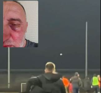  Oglasila se i Sloga: Mi smo napadnuti, a ne Željezničar! Evo dokaza (VIDEO) 