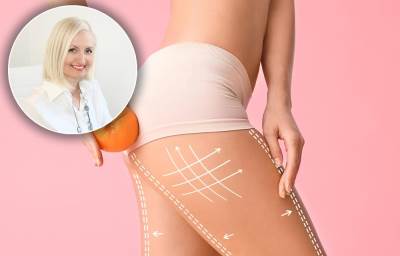  Kako se riješiti celulita savjeti dermatologa 