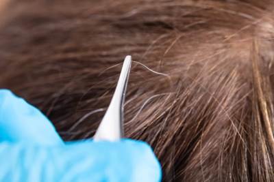  Da li treba čupati sijede 