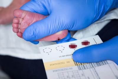  I dalje se čeka početak skrininga na SMA u Srpskoj 