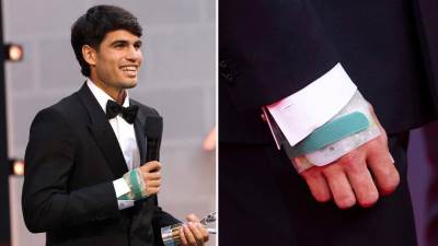  Koliko će pauzirati Karlos Alkaraz  