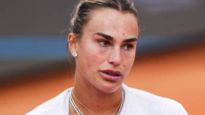 Arina Sabalenka na udaru kritika zbog napumpanih usana 