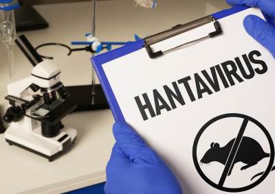  hantavirus 