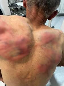  Nenad Rašković brutalno pretučen 