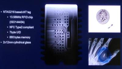  Čipovanje ljudi: Kako funkcioniše, zašto se čipujemo i kako se čipuju ljudi 